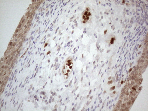m13665 anti spata22 mouse monoclonal antibody clone id oti6h9 ihc testing 5