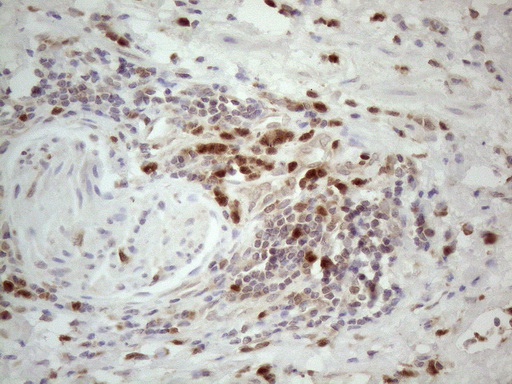 m13665 anti spata22 mouse monoclonal antibody clone id oti6h9 ihc testing 6