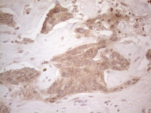 m13665 anti spata22 mouse monoclonal antibody clone id oti6h9 ihc testing 7