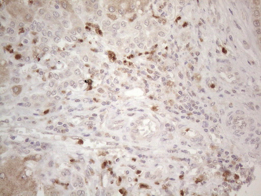 m13665 anti spata22 mouse monoclonal antibody clone id oti6h9 ihc testing 8