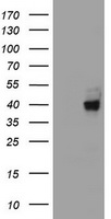 HEK293T cells were transfected with the pCMV6-ENTRY control (Left lane) or pCMV6-ENTRY A4GNT (Right lane) cDNA for 48 hrs and lysed
