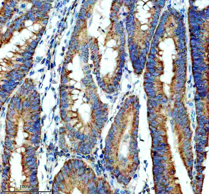IHC analysis of MRPS31 using anti-MRPS31 antibody (M13714)