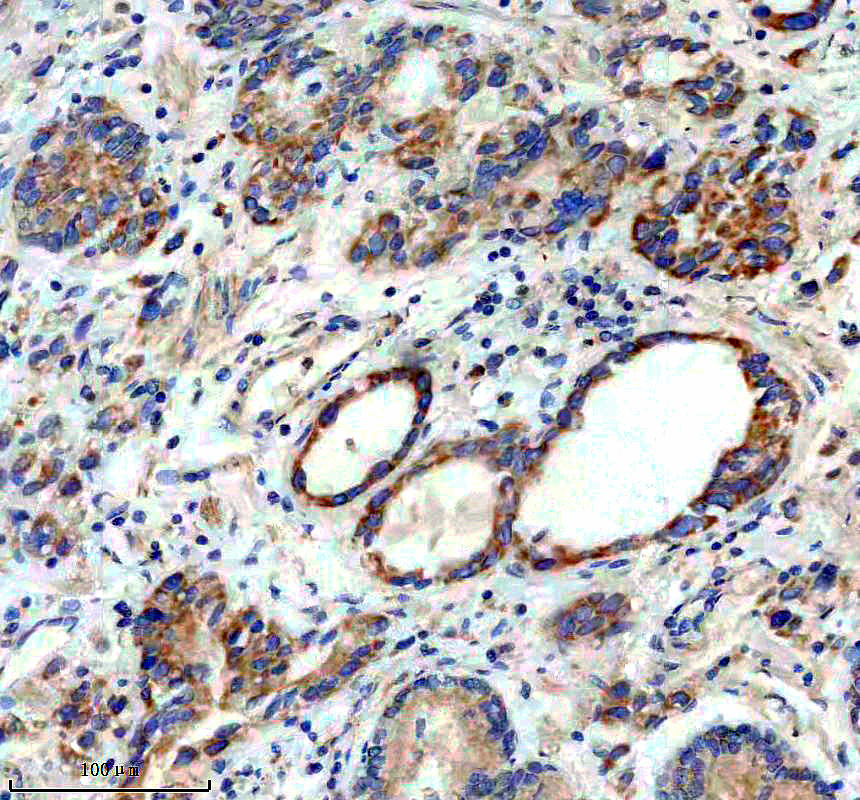 IHC analysis of MRPS31 using anti-MRPS31 antibody (M13714)