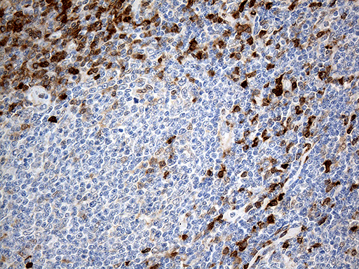 m13716 anti dnajb5 mouse monoclonal antibody clone id oti6f11 ihc testing 3