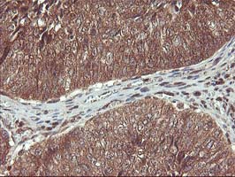 m13748 anti hdhd1a pudp mouse monoclonal antibody clone id oti7a2 ihc testing 10