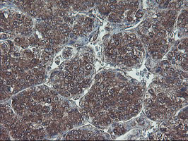 m13748 anti hdhd1a pudp mouse monoclonal antibody clone id oti7a2 ihc testing 11