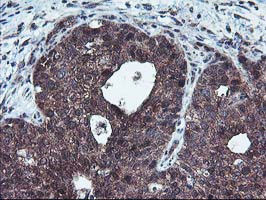 m13748 anti hdhd1a pudp mouse monoclonal antibody clone id oti7a2 ihc testing 3