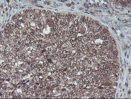 m13748 anti hdhd1a pudp mouse monoclonal antibody clone id oti7a2 ihc testing 4