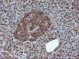 m13748 anti hdhd1a pudp mouse monoclonal antibody clone id oti7a2 ihc testing 5
