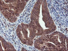m13748 anti hdhd1a pudp mouse monoclonal antibody clone id oti7a2 ihc testing 6