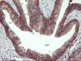 m13748 anti hdhd1a pudp mouse monoclonal antibody clone id oti7a2 ihc testing 7