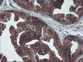 m13748 anti hdhd1a pudp mouse monoclonal antibody clone id oti7a2 ihc testing 8