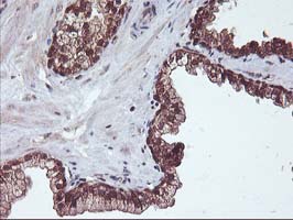 m13748 anti hdhd1a pudp mouse monoclonal antibody clone id oti7a2 ihc testing 9