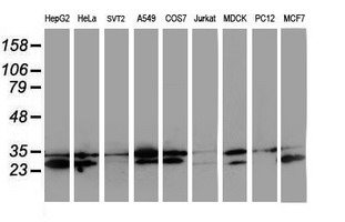 m13748 anti hdhd1a pudp mouse monoclonal antibody clone id oti7a2 wb testing 2