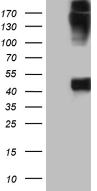 m13800 anti krt35 mouse monoclonal antibody clone id oti1a11 wb testing 1