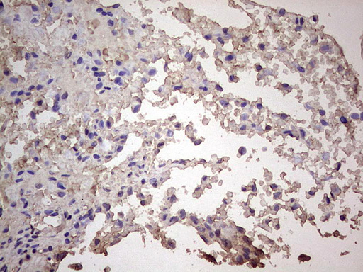 Immunohistochemical staining of paraffin-embedded Human adult brain tissue using anti-CGB mouse monoclonal antibody