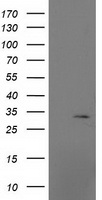 HEK293T cells were transfected with the pCMV6-ENTRY control (Left lane) or pCMV6-ENTRY MRPS2 (Right lane) cDNA for 48 hrs and lysed