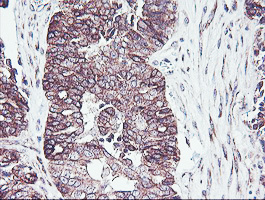 m13826 anti pdrg1 mouse monoclonal antibody clone id oti4f12 ihc testing 2