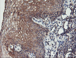 m13826 anti pdrg1 mouse monoclonal antibody clone id oti4f12 ihc testing 5