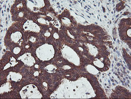 m13826 anti pdrg1 mouse monoclonal antibody clone id oti4f12 ihc testing 6