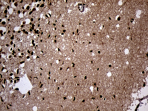 Immunohistochemical staining of paraffin-embedded Human adult brain tissue within the normal limits using anti-SPANXB1 mouse monoclonal antibody