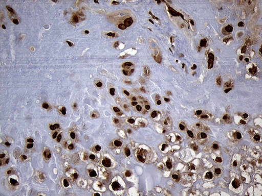 m13843 anti spanxb1 mouse monoclonal antibody clone id oti6g2 ihc testing 4