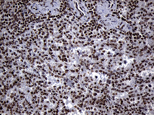 m13843 anti spanxb1 mouse monoclonal antibody clone id oti6g2 ihc testing 5