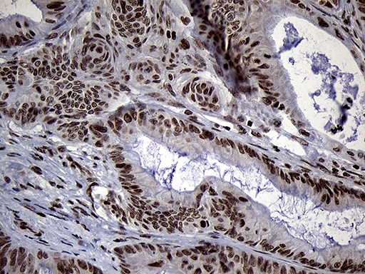 m13843 anti spanxb1 mouse monoclonal antibody clone id oti6g2 ihc testing 6