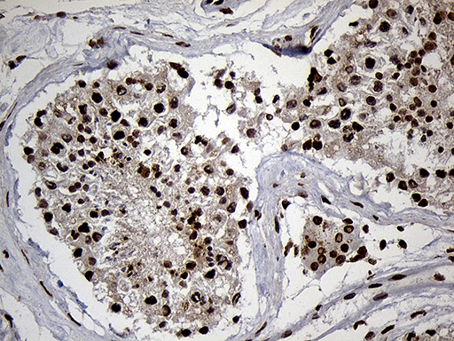 m13843 anti spanxb1 mouse monoclonal antibody clone id oti6g2 ihc testing 7