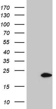 HEK293T cells were transfected with the pCMV6-ENTRY control (Left lane) or pCMV6-ENTRY SPANXB1 (Right lane) cDNA for 48 hrs and lysed