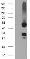 HEK293T cells were transfected with the pCMV6-ENTRY control (Left lane) or pCMV6-ENTRY MFAP3 (Right lane) cDNA for 48 hrs and lysed