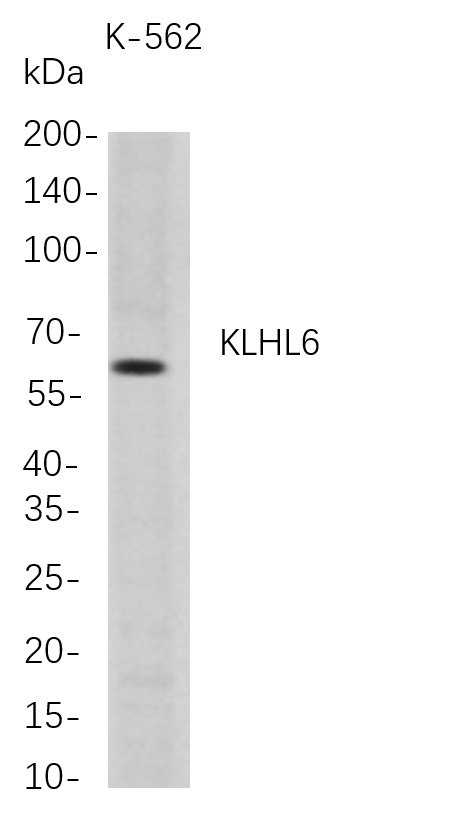 m13962 1 klhl6 primary antibodies wb testing 1
