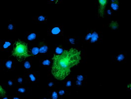 m13975 1 anti breast cancer suppressor candidate 1 vwa5a mouse monoclonal antibody clone id oti3a3 if testing 4