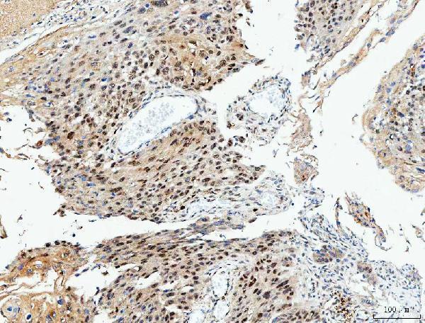 IHC analysis of VWA5A using anti-VWA5A antibody (M13975)
