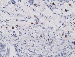 Immunohistochemical staining of paraffin-embedded Human bladder tissue within the normal limits using anti-SDR9C7 mouse monoclonal antibody