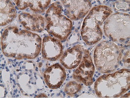 Immunohistochemical staining of paraffin-embedded Human Kidney tissue within the normal limits using anti-SDR9C7 mouse monoclonal antibody