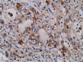 m13978 anti sdr o sdr9c7 mouse monoclonal antibody clone id oti4b5 ihc testing 4
