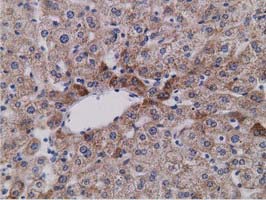 m13978 anti sdr o sdr9c7 mouse monoclonal antibody clone id oti4b5 ihc testing 5