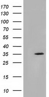 HEK293T cells were transfected with the pCMV6-ENTRY control (Left lane) or pCMV6-ENTRY SDR9C7 (Right lane) cDNA for 48 hrs and lysed