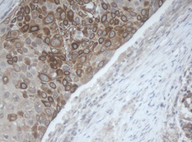 m13984 anti mageb1 mouse monoclonal antibody clone id oti4e12 ihc testing 3