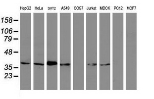 m13984 anti mageb1 mouse monoclonal antibody clone id oti4e12 wb testing 2