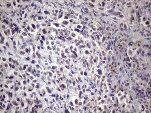 m13990 anti xrcc6bp1 atp23 mouse monoclonal antibody clone id oti5f3 ihc testing 4