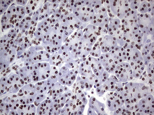 Immunohistochemical staining of paraffin-embedded Human pancreas tissue within the normal limits using anti-N4BP2L2 mouse monoclonal antibody