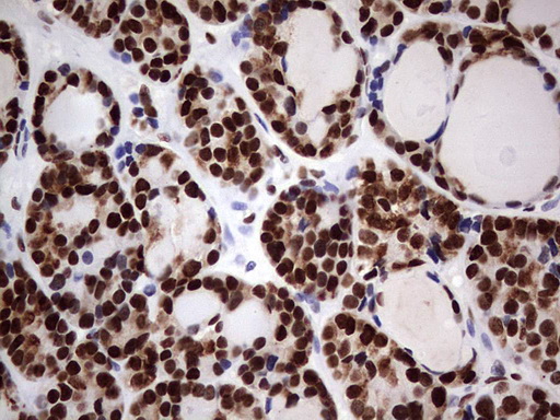 m14016 anti n4bp2l2 mouse monoclonal antibody clone id oti1c8 ihc testing 4