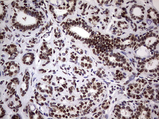 m14016 anti n4bp2l2 mouse monoclonal antibody clone id oti1c8 ihc testing 5