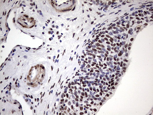m14016 anti n4bp2l2 mouse monoclonal antibody clone id oti1c8 ihc testing 6