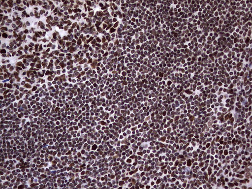 m14016 anti n4bp2l2 mouse monoclonal antibody clone id oti1c8 ihc testing 7