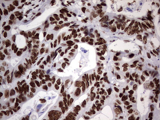 m14016 anti n4bp2l2 mouse monoclonal antibody clone id oti1c8 ihc testing 8