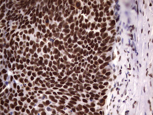 m14016 anti n4bp2l2 mouse monoclonal antibody clone id oti1c8 ihc testing 9
