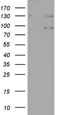 HEK293T cells were transfected with the pCMV6-ENTRY control (Left lane) or pCMV6-ENTRY N4BP2L2 (Right lane) cDNA for 48 hrs and lysed